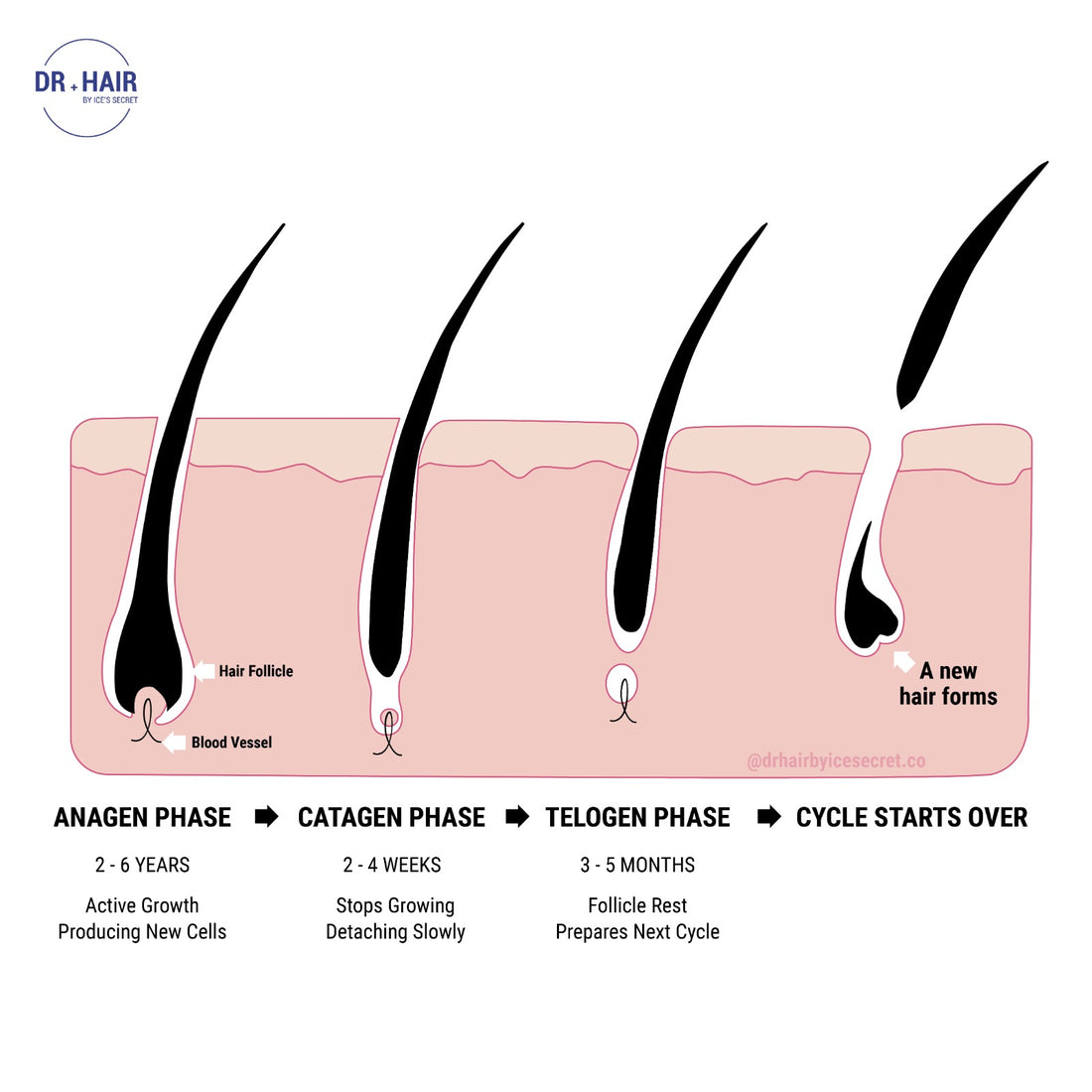 Hair loss - why it happens